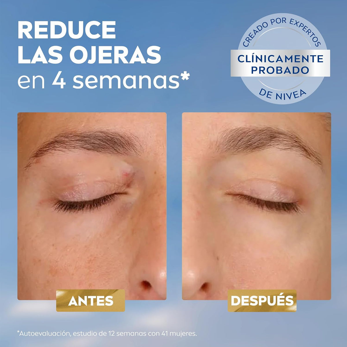 NIVEA Luminous630 - Contorno De Ojos - Crema Antimanchas - Con Ácido Hialurónico, Thiamidol Y Cafeína - Antiedad - Crema Antiarrugas - Reduce Hinchazón Y Ojeras - Todo Tipo De Pieles - 15 Ml
